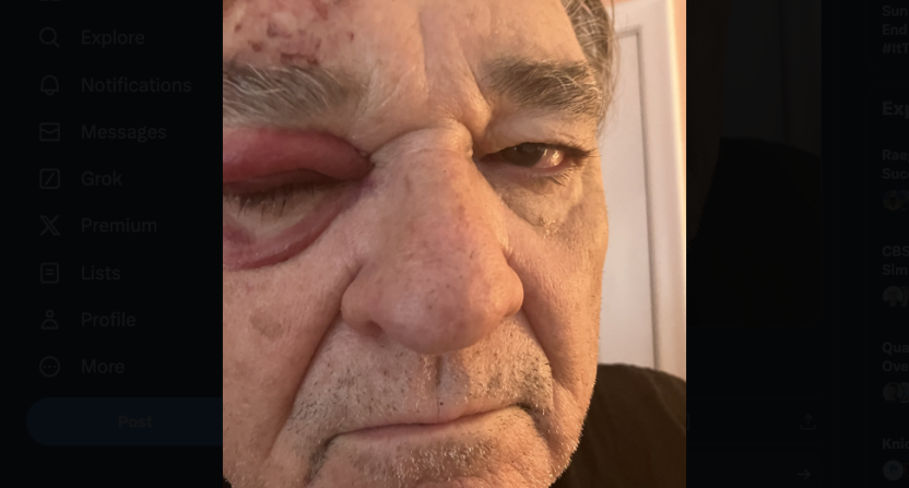 Greg Cote